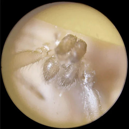  Analyzing image     Marvin-Scope-view-spider-under-kids-portable-microscope